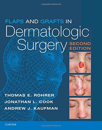 Flaps and Grafts in Dermatologic Surgery: Text with DVD