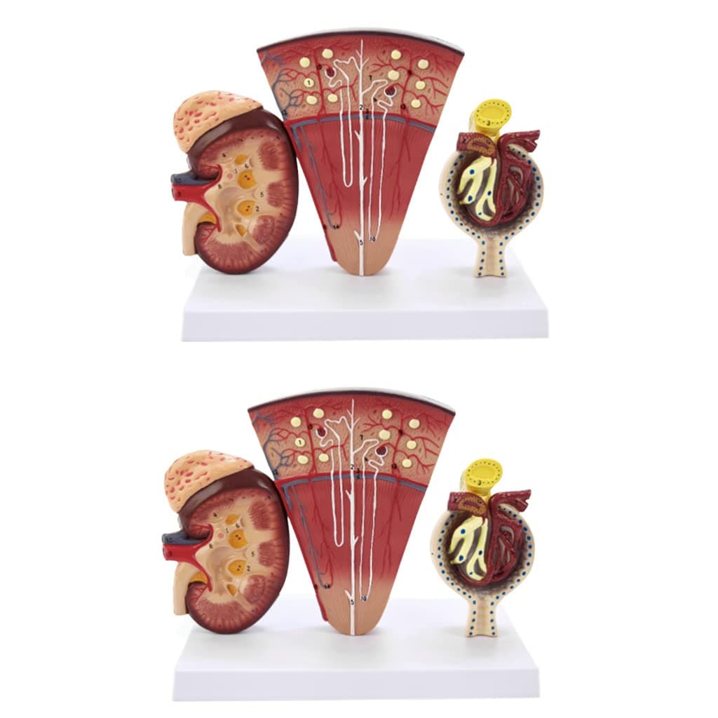 Teaching Model Human Organ Anatomy Model Glomerular Model Urinary System Anatomy Human Kidney Model Kidney Model Medical Model