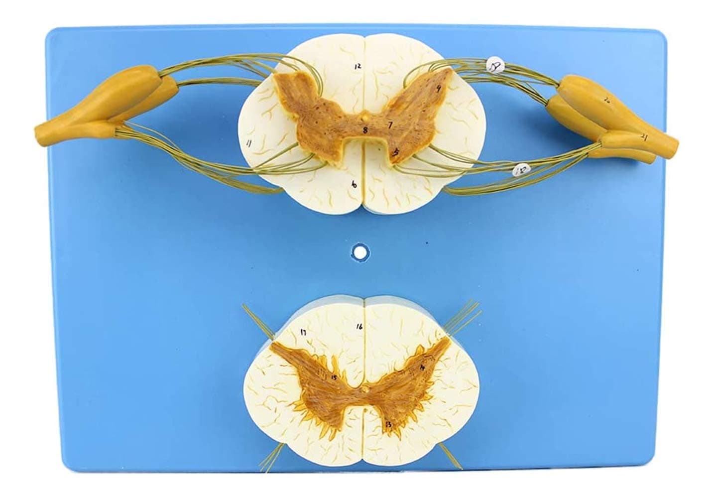 LAErper Teaching Model, Human Spinal Cord Spinal Nerve Branch Model, Peripheral Nervous System Spine Anatomy Spinal Nerve Anesthesiology for Medical Training Teaching Anatomy Biology