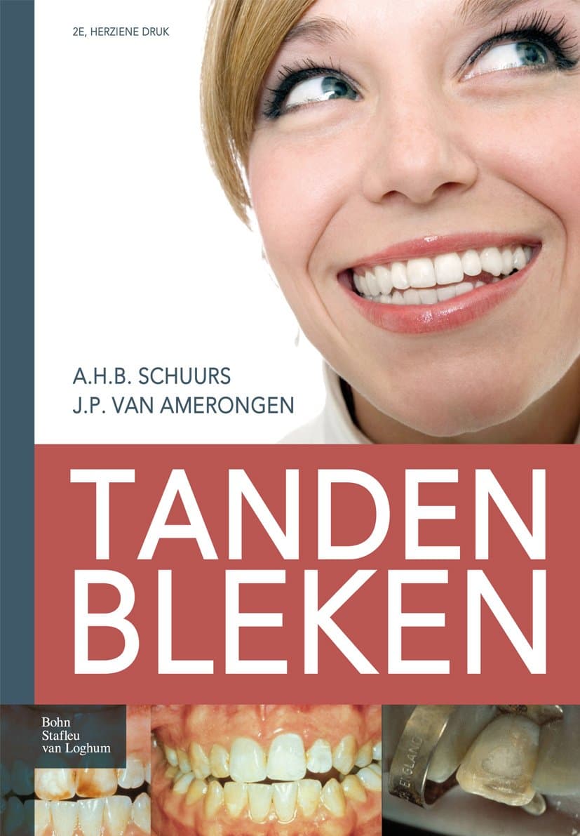 Tanden bleken (Dutch Edition)