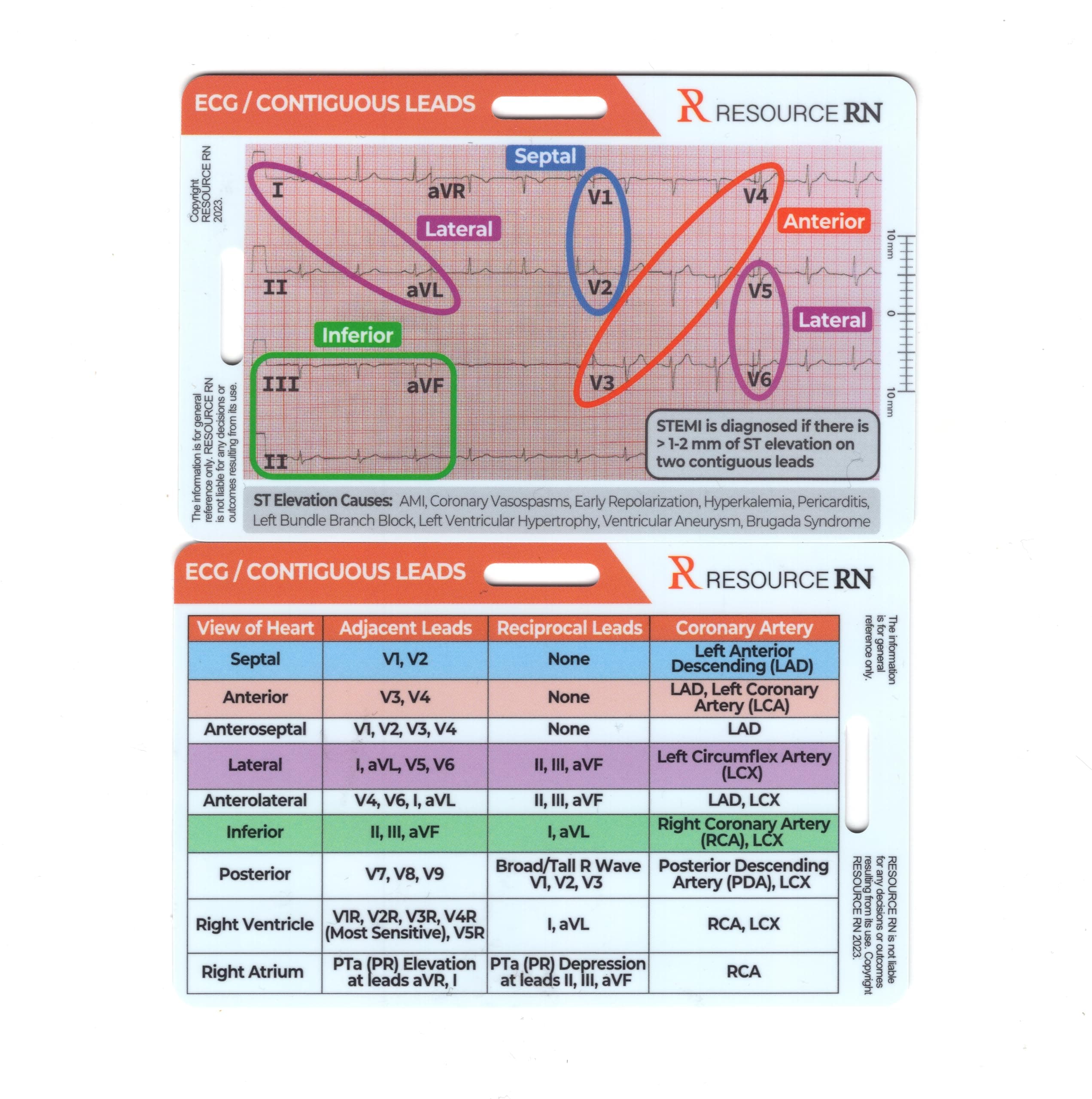 EKG STEMI Analysis Badge Card for Rapid Interpretation – Compatible for Both Horizontal & Vertical Layout