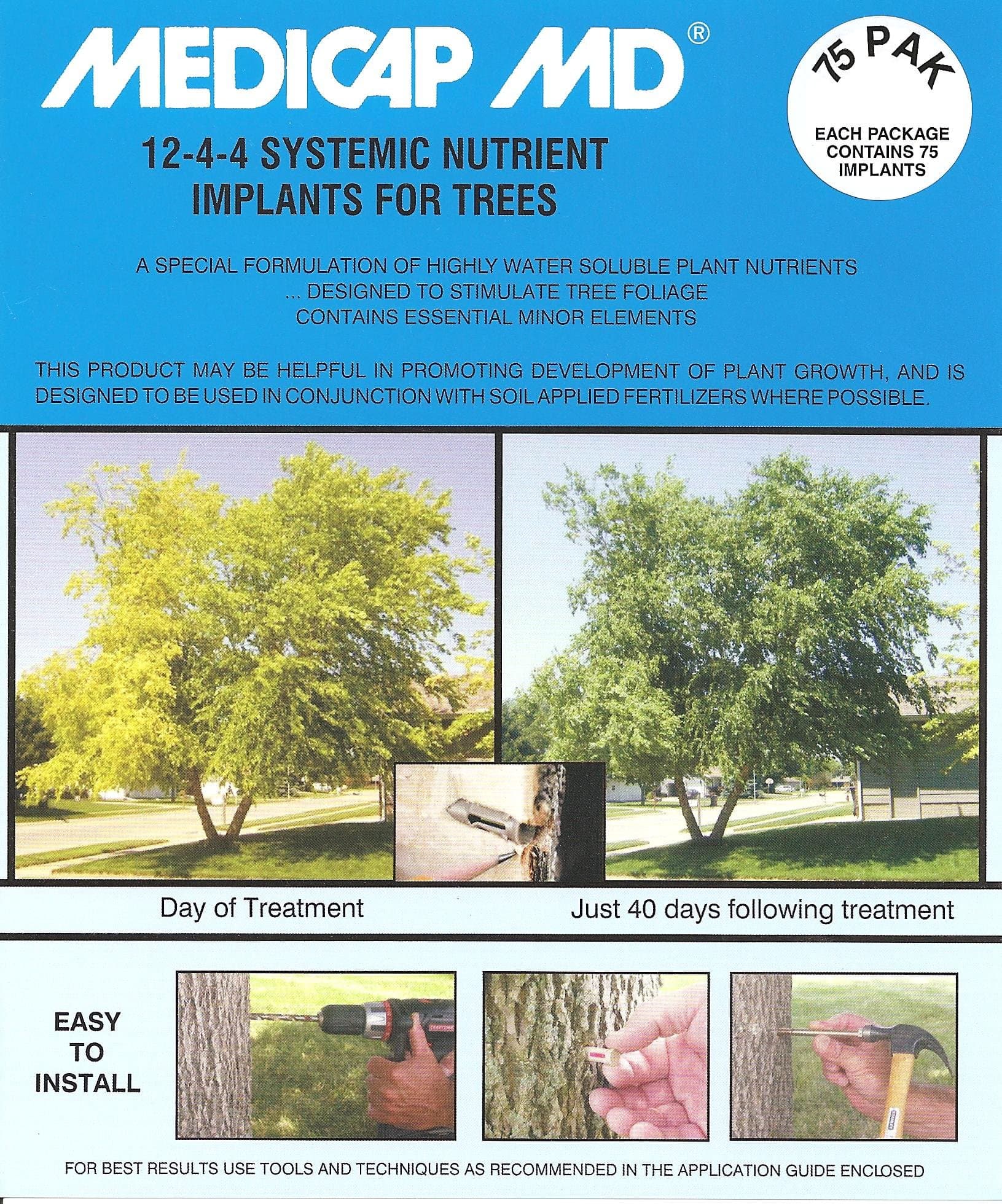 75-Pack MD Systemic 12-4-4 Tree Food Implants, 3/8-Inch