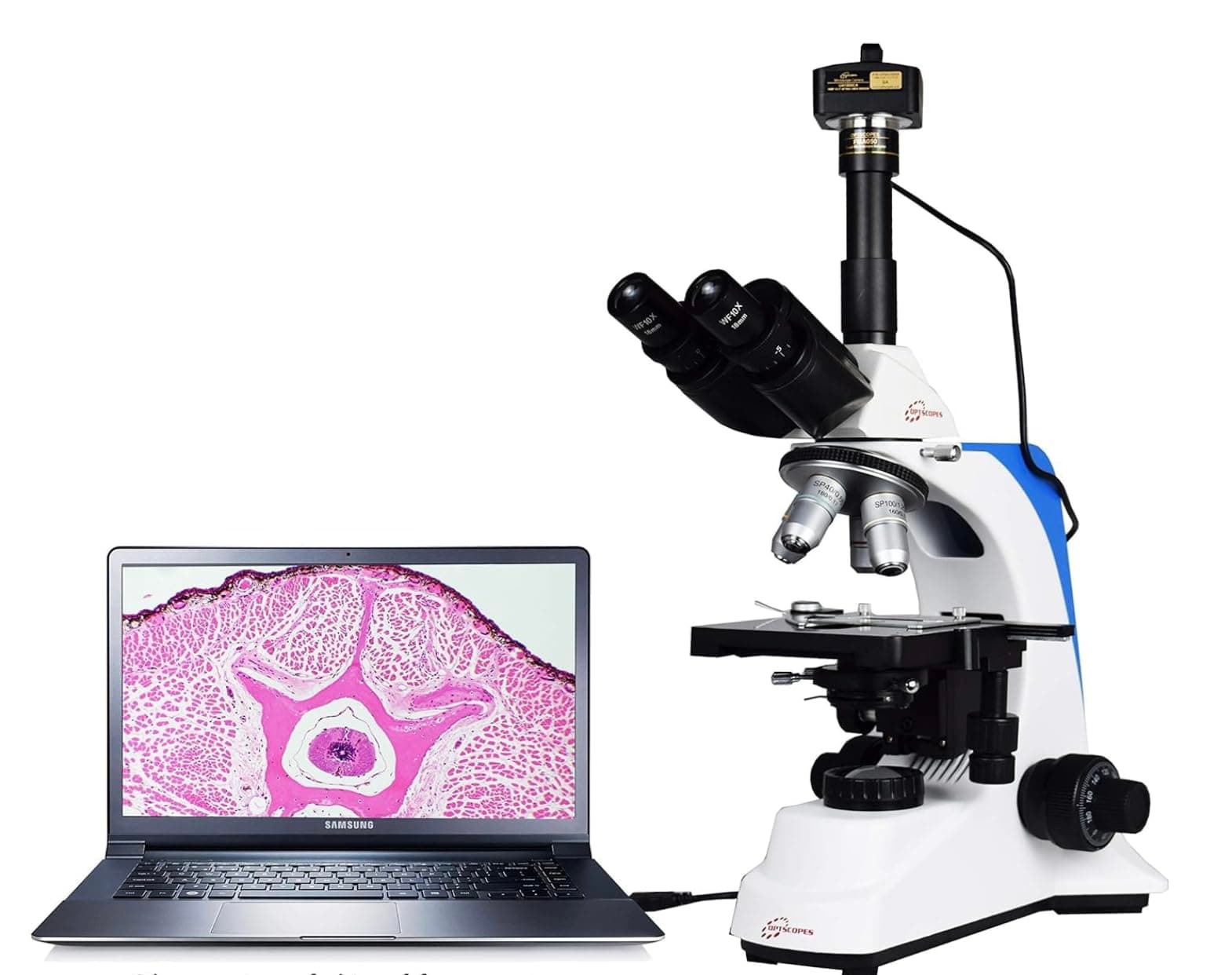 Optscopes Advance 40x-2000x Digital Microscope with 5.1MP IS-500 CMOS Microscope Camera (for Education, Pathology, Research and Teaching)